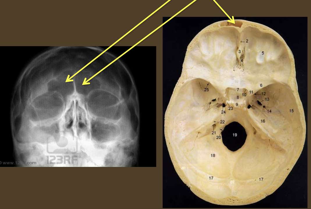 term image