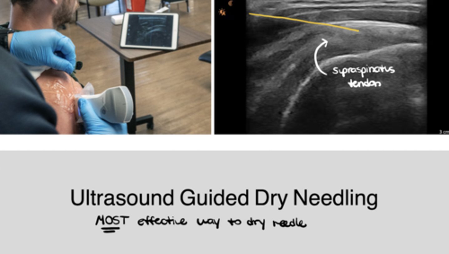 <p>Interventional</p>