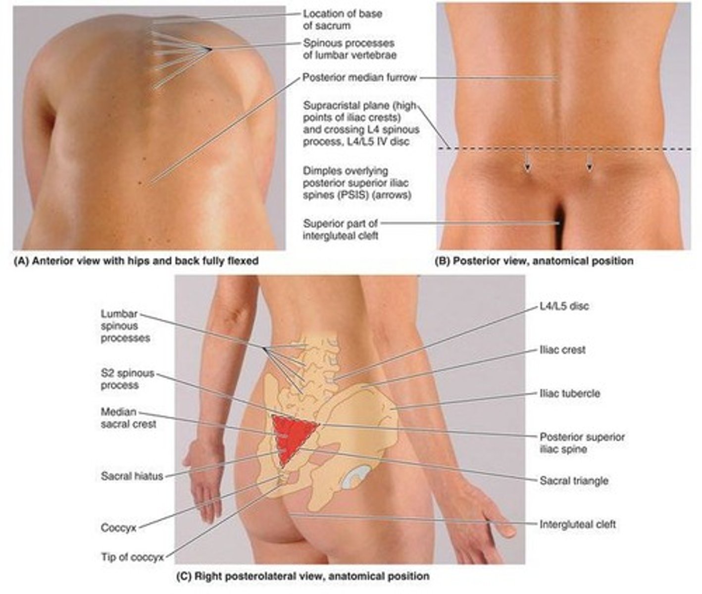 <p>The angle formed between the lumbar spine and the sacrum, varying from 130-160 degrees.</p>