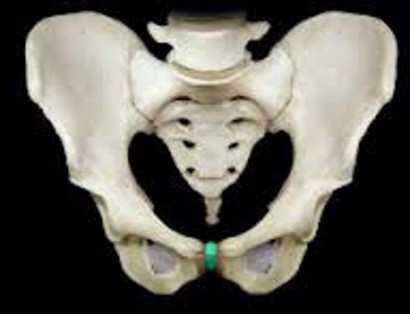 <p>cartilage sitting between right and left pubic bones</p>