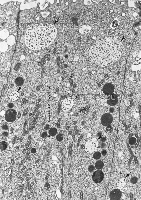 <p>What organelle are the dark spots?</p>