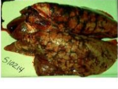 <p>Margin of the lesion</p>