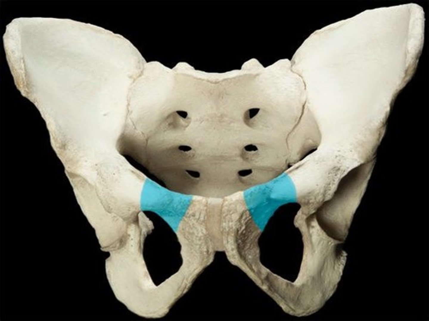 <p>forms part of acetabulum</p>