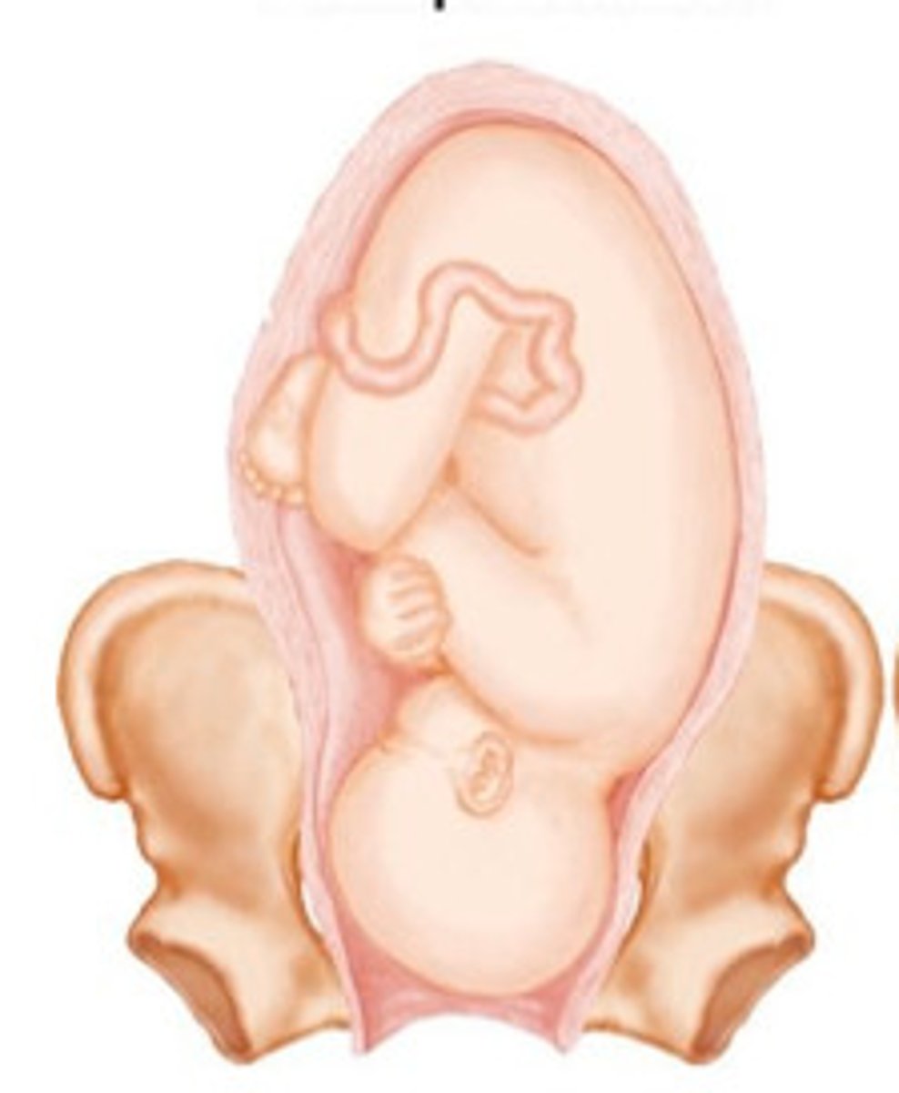 <p>birth position in which any part of the head emerges first</p>