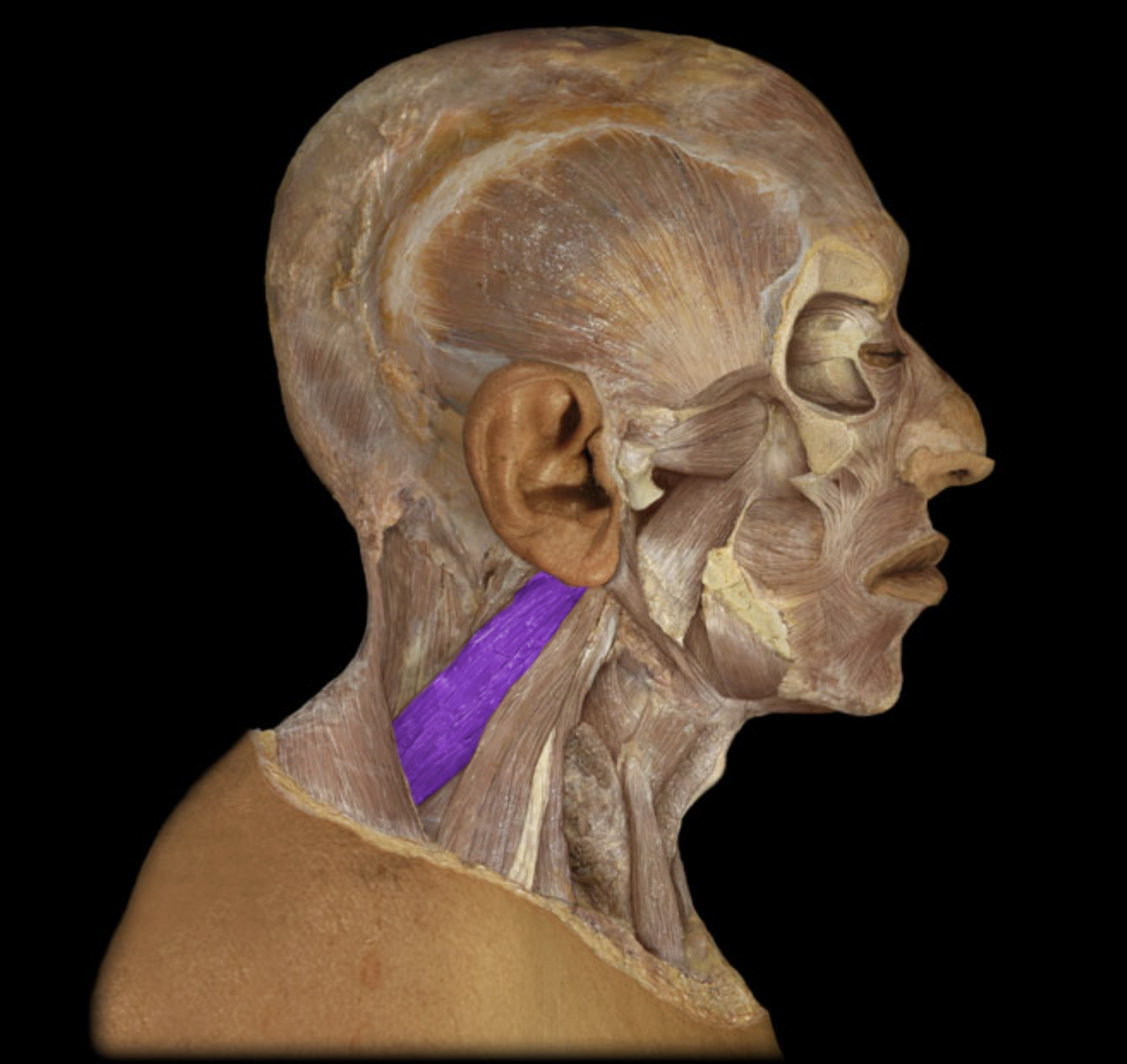 <p>What is/are this muscle’s insertion(s)?</p>