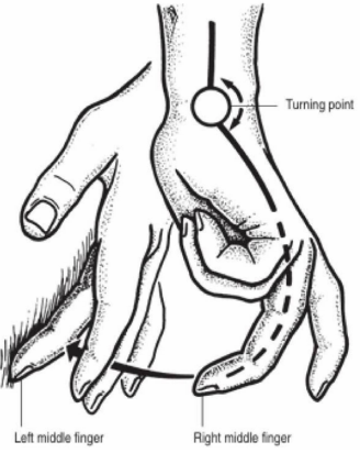 <p>What do you call to this procedure? </p>