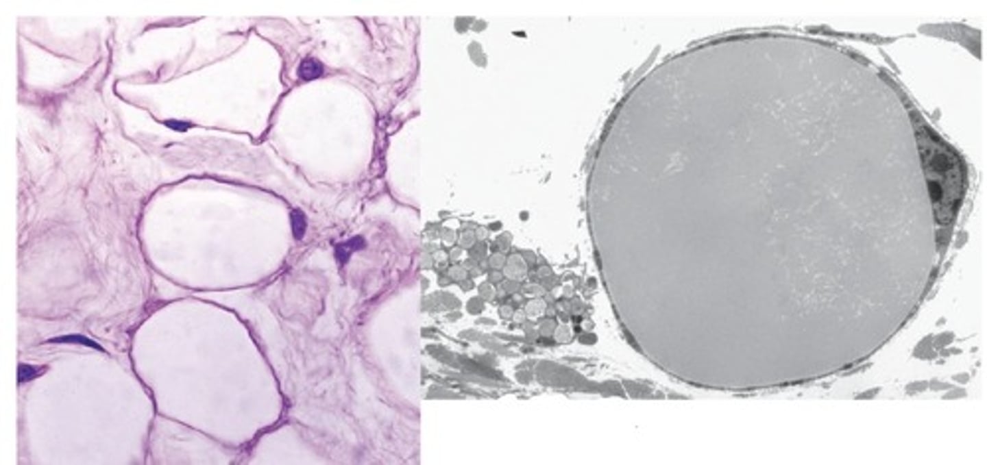 <p>What adipose tissue is this?</p>