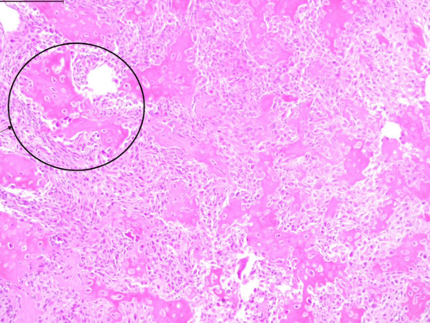 <p>Identify the pathology:</p>