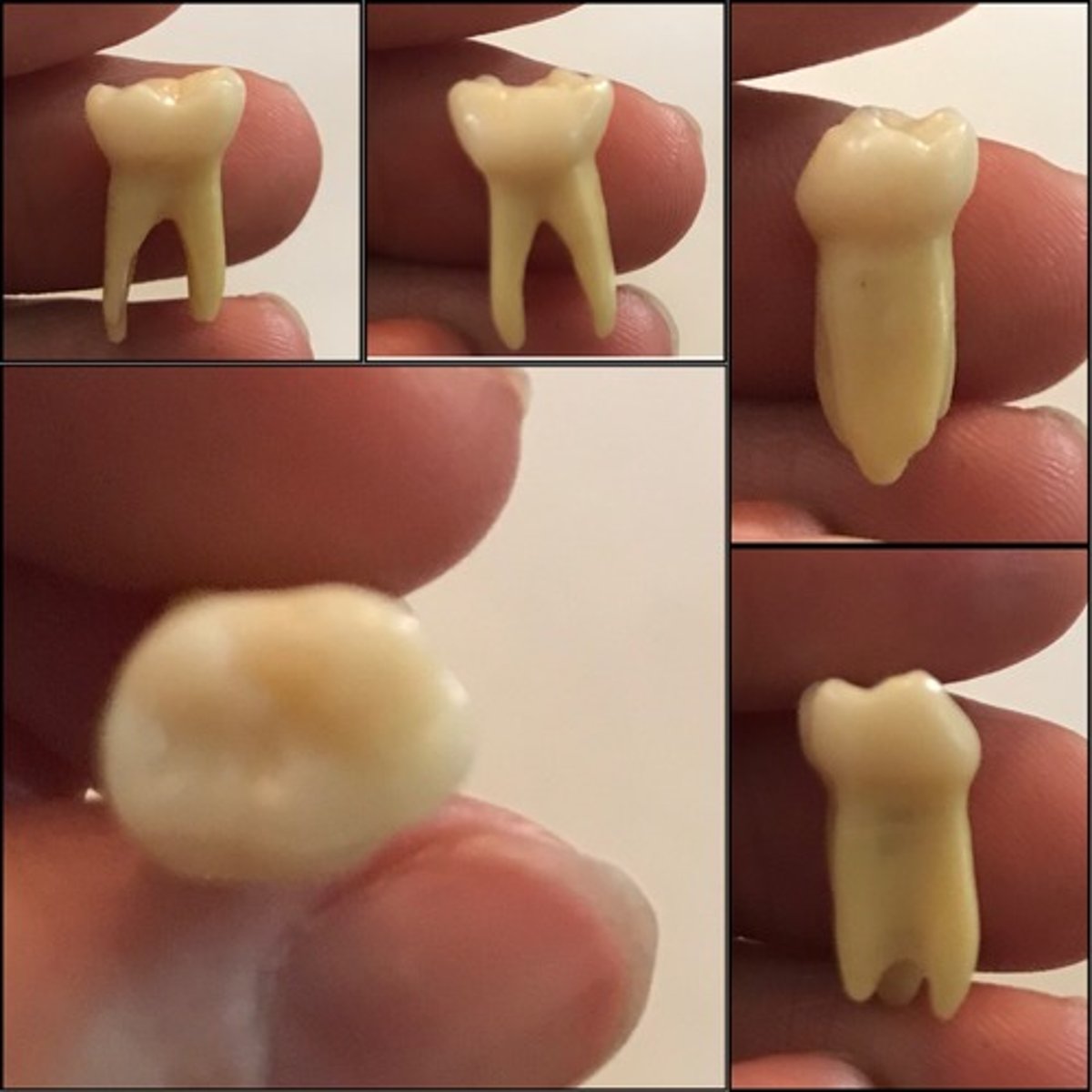 <p>What tooth is this ?</p>