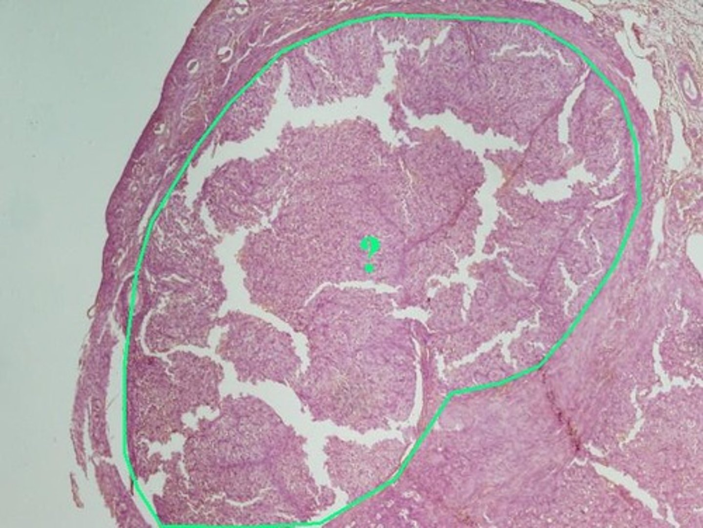 <p>corpus luteum</p>