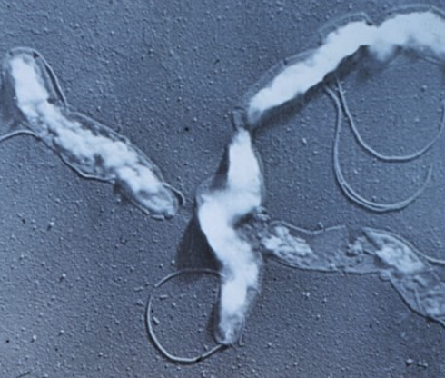 <p>persists in the uterus/uterine tubes for weeks to months</p><p>persists in the vagina for up to 24 months (these animals are carriers)</p>