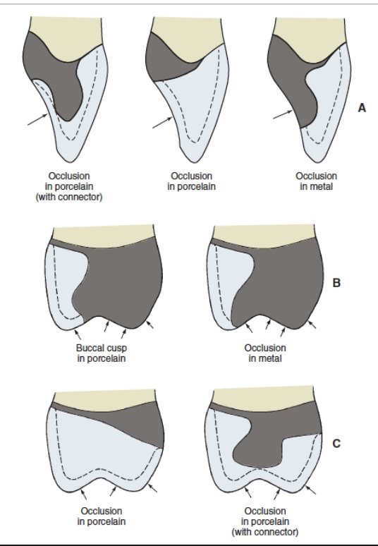 <ul><li><p>margin </p></li><li><p>occlusion </p></li><li><p>proximal contacts </p></li></ul><p></p>