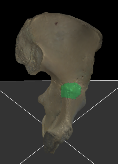 <p>De verhevenheid die zichtbaar is op de grens tussen het os ilium en het os pubis, die een aanhechtingspunt voor ligamenten biedt.</p>