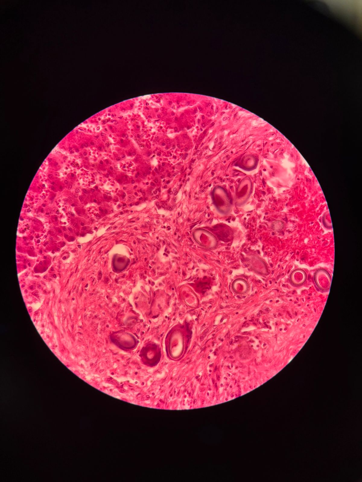 term image