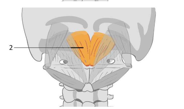 <p>what muscle is this </p>