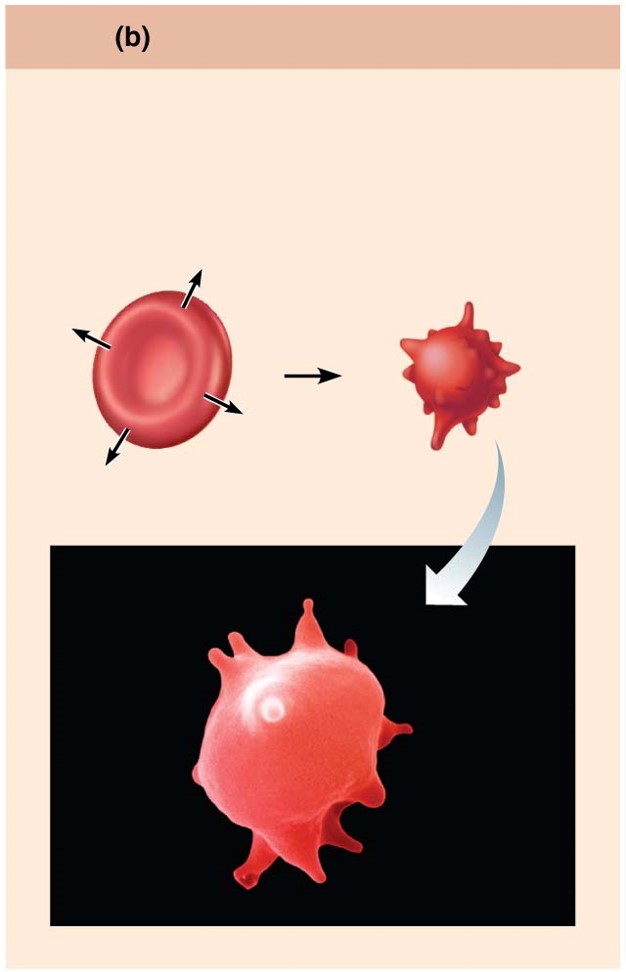 What type of solution is represented by the shrinking cell below?