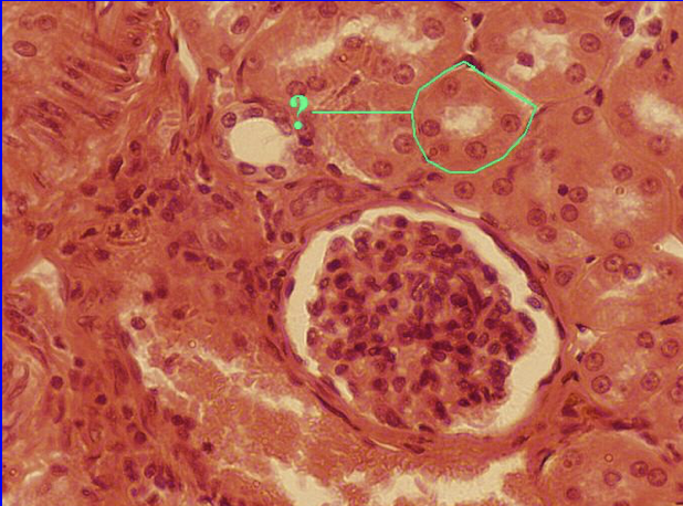 term image