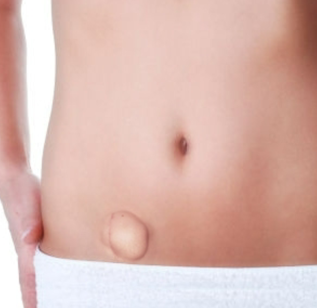 <p>ascends through the <span style="color: rgb(228, 201, 255);"><strong>inguinal canal</strong></span></p><ul><li><p>weakness here may cause hernia</p></li></ul><p></p>