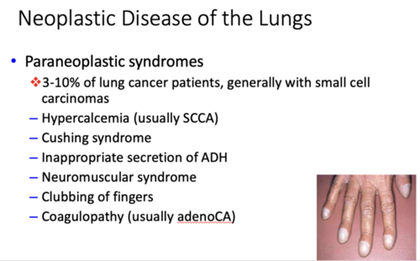 <p>paraneoplastic syndromes</p>