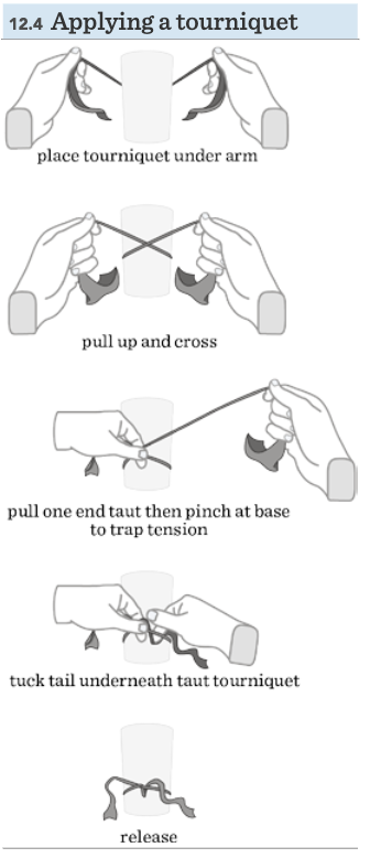 3-4 inches above venipuncture site, don’t leave it on longer than 1 min