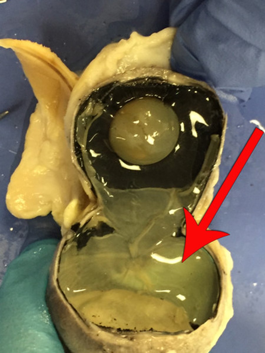 <p>a layer at the back of the eyeball containing cells that are sensitive to light and that trigger nerve impulses that pass via the optic nerve to the brain, where a visual image is formed.</p>