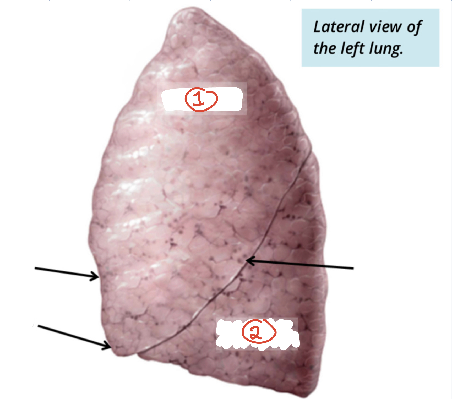 Lobes of Left Lung (2)