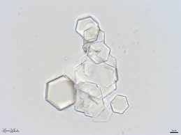 <p>What crystal is this?</p>