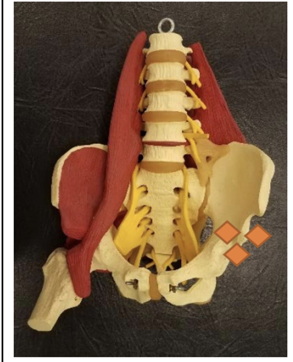 <p>inferior to AIIS</p>