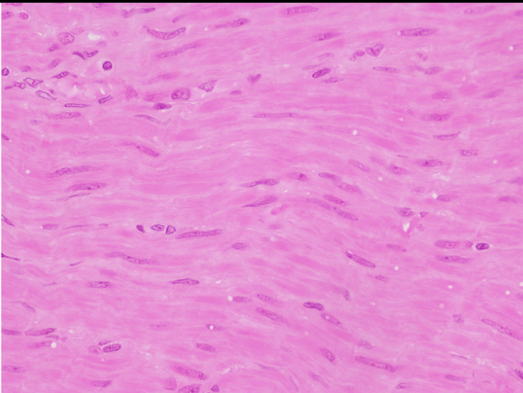 <p>What type of muscle tissue is this?</p>