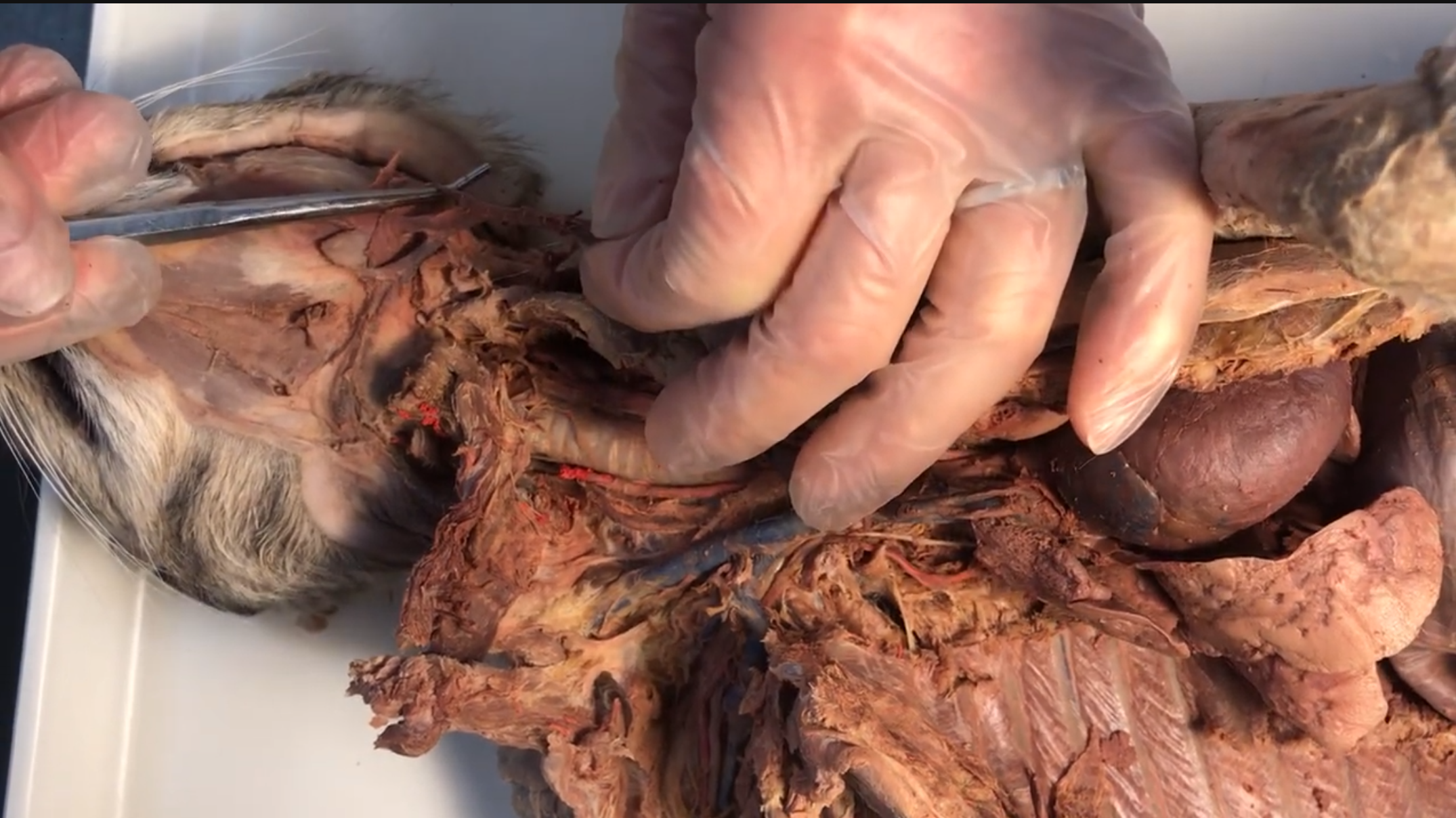 <p>What vein is this</p>