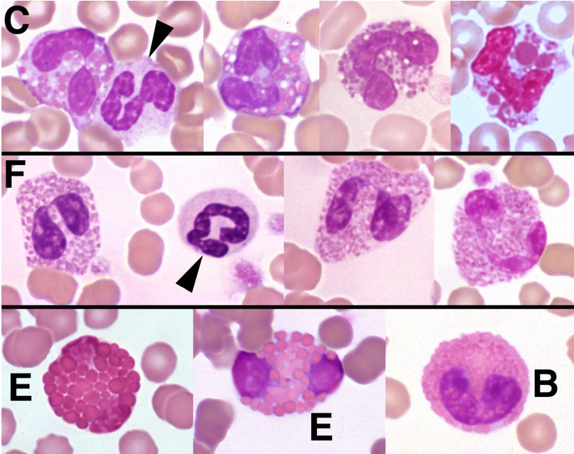 * Pink orange staining cytoplasmic granules
* Shape, density, staining can very among spp

FXN

Worms, wheezes, weird diseases

* Parasites
* Hypersensitivity, allergy
* Inflammation of skin, gut, respiratory system
* Addison's disease, etc