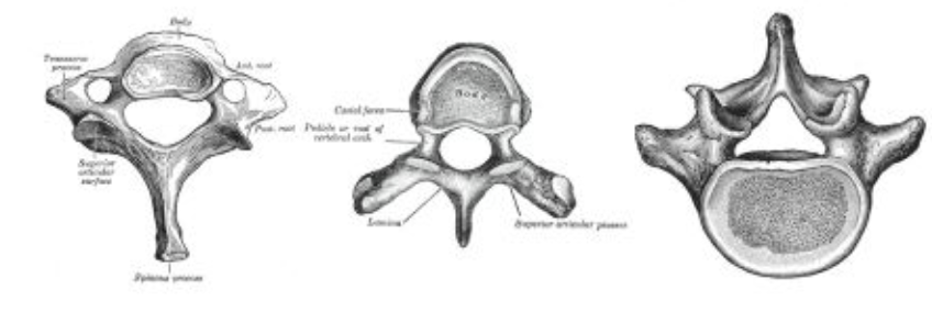 <p>Which is what type of vertebrae?&nbsp;</p>