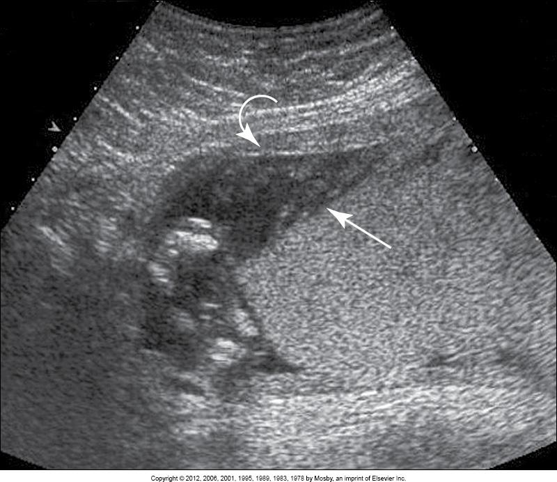 <p>What is this image showing? </p>