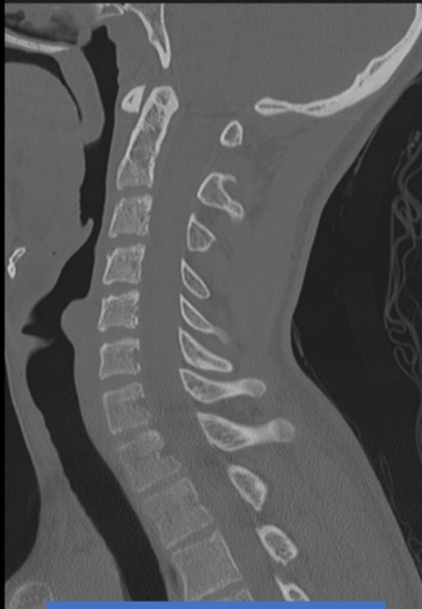 <p>What plane is this?</p>