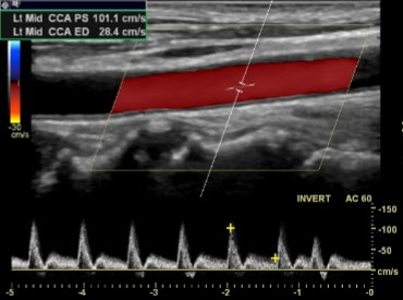<ol><li><p>What kind of imaging is seen here?</p></li><li><p>It is the primary tool for the evaluation of what?</p></li></ol><p></p>