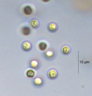 <p>freshwater plankton; considered benign</p>