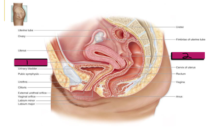 <p>#1</p><p>-Important anatomical landmark for c-sections </p>