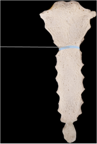 The highlighted structure is an important clinical marker. What is its significance?