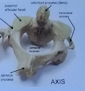 <ul><li><p>Second cervical vertebrae of the vertebral column </p></li><li><p>Allows “no” motion of the head</p></li></ul><p></p>