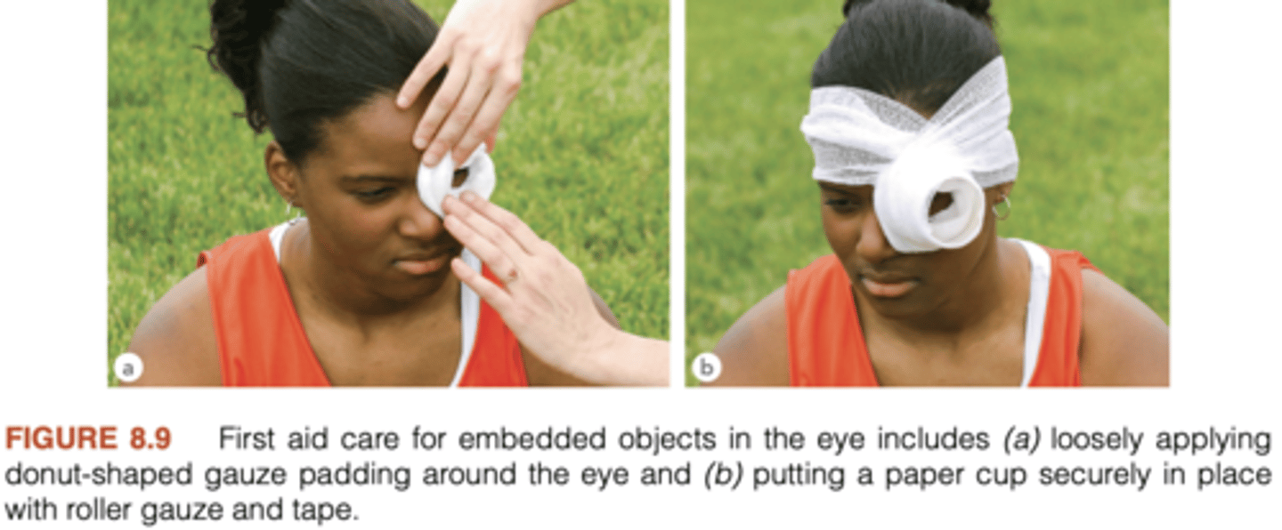 <p>Occur when the epithelium of the eye's surface</p>