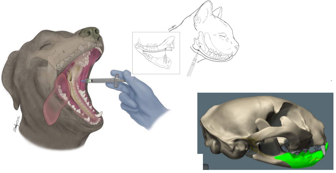 <p>which nerve block is this</p>