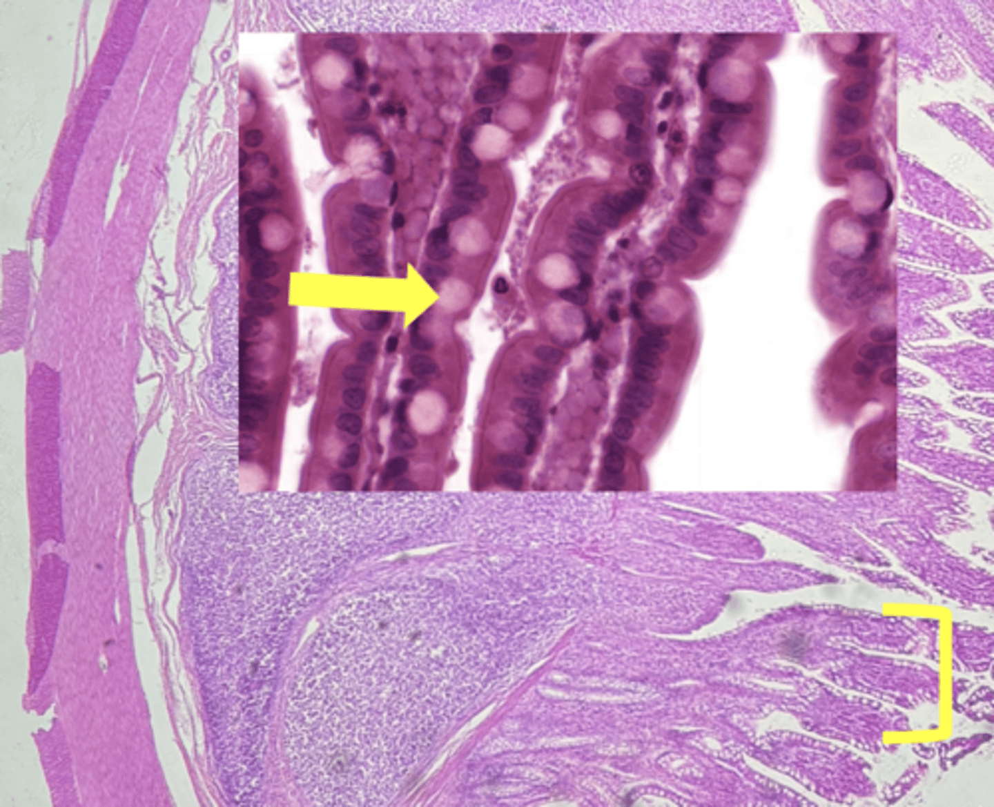 <p>type of cell & what it secretes</p>