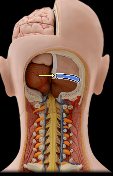 <p>Transverse sinus</p>