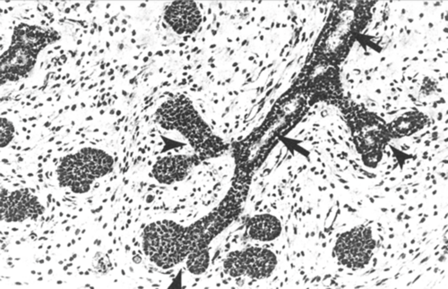 <p>inner</p><p>outer</p>