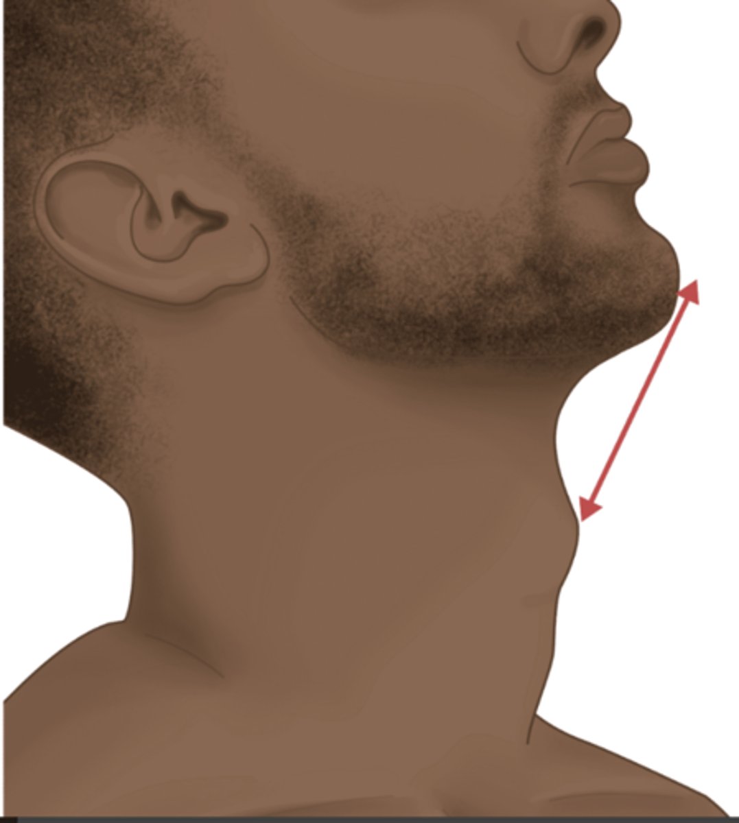 <p>Helps estimate the size of the submandibular space. </p><p>With the neck extended and mouth closed, you can measure the distance from the tip of the thyroid cartilage to the tip of the mentum. </p><p>DL ↑ difficulty if </p><p>< 6 cm (3 fingerbreadths) or </p><p>> 9 cm</p>