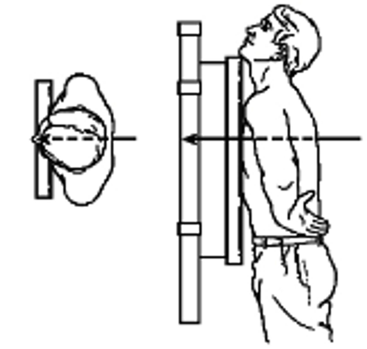 <p>what type of projection is this?</p><p>a. Posteroanterior</p><p>b. Anteroposterior</p><p>c. Left Lateral</p><p>d. AP oblique</p>