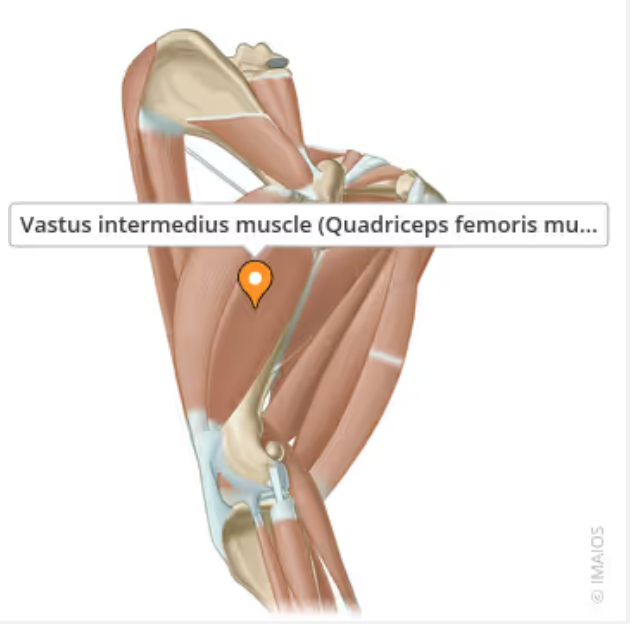 <p>Well developed extensor muscle of the thigh. Extends the stifle while also flexing the hip. Opposes the hamstring . Originates on both the pelvis and femur and ends at the patella (and extends directly to the tibia via the patellar ligament</p>