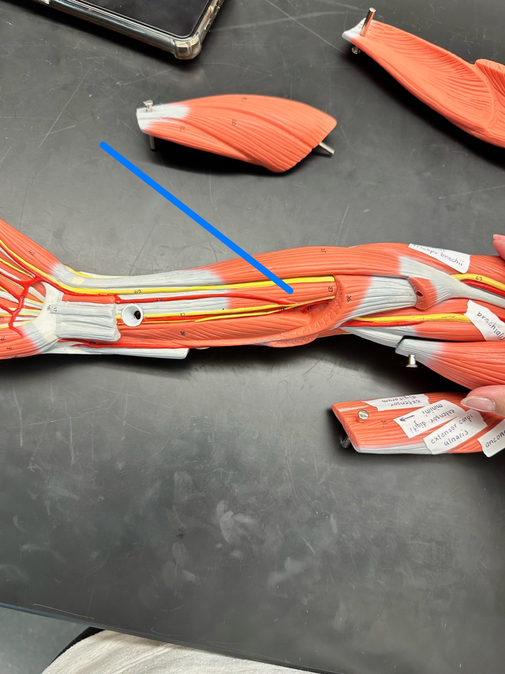 <p>ID muscle</p>