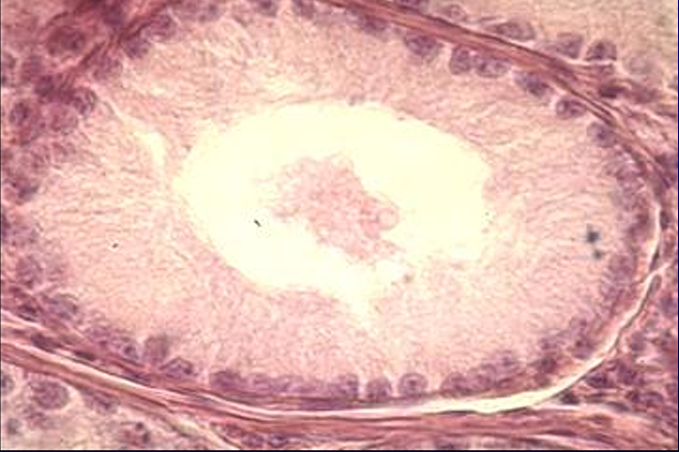 <p>Identify the structure:</p><p>Specie:</p><p>Lined by:</p>