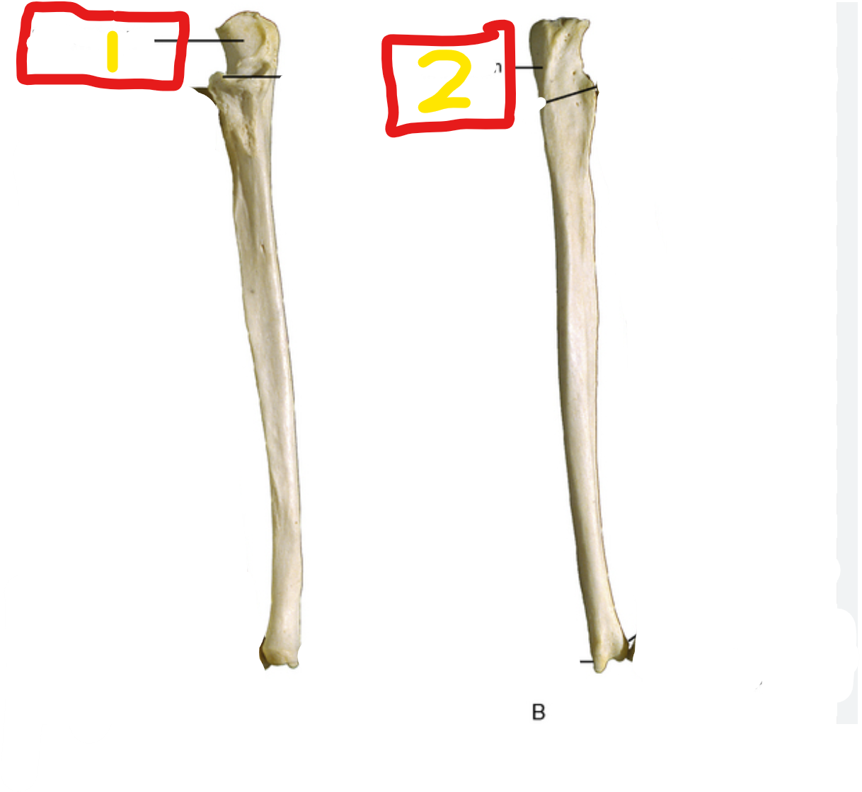 <p>what bone is this?</p>